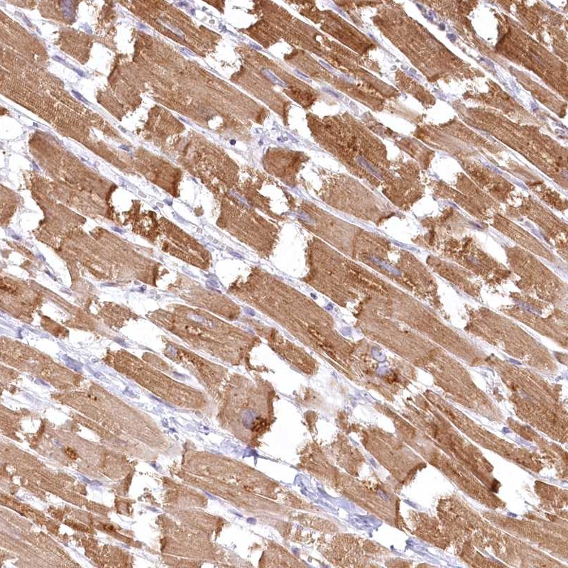 Anti-INPP4B Antibody