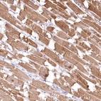 Anti-INPP4B Antibody