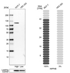 Western blot analysis in human cell lines MCF-7 and HEK293 using Anti-INPP4B antibody. Corresponding INPP4B RNA-seq data are presented for the same cell lines. Loading control: Anti-PPIB.