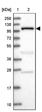 Lane 1: Marker [kDa] 250, 130, 95, 72, 55, 36, 28, 17, 10_br/_Lane 2: Human cell line RT-4