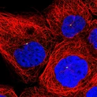 Immunofluorescent staining of human cell line A-431 shows localization to centrosome.