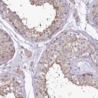 Immunohistochemical staining of human testis shows moderate membranous positivity in cells in seminiferous ducts.