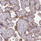 Immunohistochemical staining of human placenta shows weak to moderate membranous and cytoplasmic positivity in trophoblastic cells.