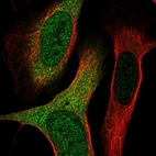 Immunofluorescent staining of human cell line U-2 OS shows localization to nucleoplasm & cytosol.