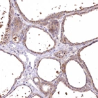 Immunohistochemical staining of human thyroid gland shows moderate cytoplasmic positivity in glandular cells.