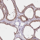 Immunohistochemical staining of human thyroid gland shows moderate cytoplasmic positivity in glandular cells.