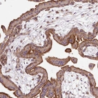 Immunohistochemical staining of human placenta shows strong cytoplasmic positivity in trophoblastic cells.