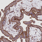 Immunohistochemical staining of human placenta shows strong cytoplasmic positivity in trophoblastic cells.