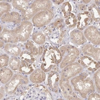 Immunohistochemical staining of human kidney shows moderate cytoplasmic positivity in cells in tubules.
