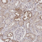 Immunohistochemical staining of human kidney shows moderate cytoplasmic positivity in cells in tubules.