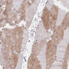 Immunohistochemical staining of human skeletal muscle shows weak cytoplasmic positivity in myocytes.