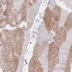 Immunohistochemical staining of human skeletal muscle shows weak cytoplasmic positivity in myocytes.