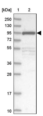 Lane 1: Marker [kDa] 250, 130, 95, 72, 55, 36, 28, 17, 10_br/_Lane 2: Human cell line RT-4