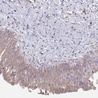 Anti-SHROOM1 Antibody