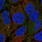 Immunofluorescent staining of human cell line CACO-2 shows localization to vesicles.