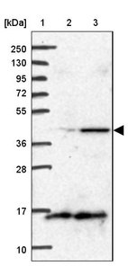 Lane 1: Marker [kDa] 250, 130, 95, 72, 55, 36, 28, 17, 10_br/_Lane 2: Human cell line RT-4_br/_Lane 3: Human cell line U-251MG sp