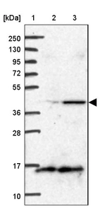 Lane 1: Marker [kDa] 250, 130, 95, 72, 55, 36, 28, 17, 10_br/_Lane 2: Human cell line RT-4_br/_Lane 3: Human cell line U-251MG sp