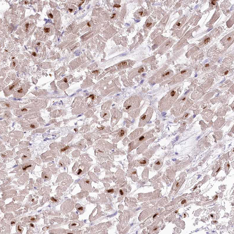 Anti-RBM20 Antibody