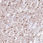 Anti-RBM20 Antibody