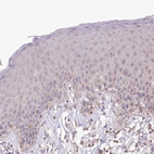 Immunohistochemical staining of human skin shows no positivity in keratinocytes.