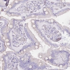 Immunohistochemical staining of human duodenum shows no positivity in glandular cells as expected.