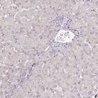 Immunohistochemical staining of human liver shows no positivity in hepatocytes as expected.