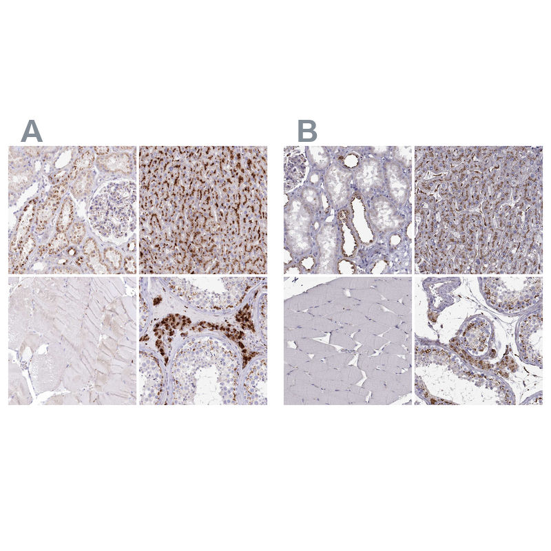 Anti-TPP1 Antibody