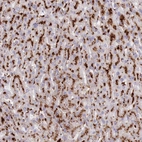Immunohistochemical staining of human liver shows strong cytoplasmic granular positivity in hepatocytes.