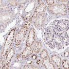 Immunohistochemical staining of human kidney shows strong cytoplasmic granular positivity in cells in tubules.