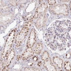 Immunohistochemical staining of human kidney shows strong cytoplasmic granular positivity in cells in tubules.
