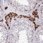 Immunohistochemical staining of human testis shows strong cytoplasmic granular positivity in Leydig cells.