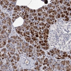 Anti-RASSF6 Antibody