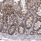 Immunohistochemical staining of human colon shows strong cytoplasmic positivity in glandular cells and lymphoid cells.