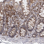 Immunohistochemical staining of human colon shows strong cytoplasmic positivity in glandular cells and lymphoid cells.