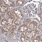Anti-RASSF6 Antibody