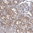 Immunohistochemical staining of human kidney shows strong cytoplasmic positivity in cells in tubules.