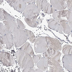 Immunohistochemical staining of human skeletal muscle shows no positivity in myocytes as expected.