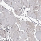 Immunohistochemical staining of human skeletal muscle shows no positivity in myocytes as expected.