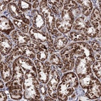 Anti-ACAD9 Antibody