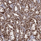Anti-ACAD9 Antibody