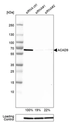 Western blot analysis in MCF-7 cells transfected with control siRNA, target specific siRNA probe #1 and #2, using Anti-ACAD9 antibody. Remaining relative intensity is presented. Loading control: Anti-GAPDH.