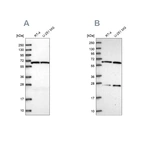 Western blot analysis using Anti-ACAD9 antibody HPA037716 (A) shows similar pattern to independent antibody HPA046720 (B).