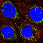 Immunofluorescent staining of human cell line A-431 shows localization to mitochondria.