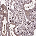 Immunohistochemical staining of human Endometrium shows moderate nuclear positivity in stromal and glandular cells.
