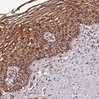 Immunohistochemical staining of human Cervix shows moderate nuclear positivity in squamous epithelial cells.
