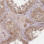 Immunohistochemical staining of human Testis shows moderate nuclear positivity in cells in seminiferous ducts and Leydig cells.