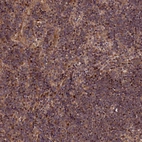 Immunohistochemical staining of human Lymph node shows moderate nuclear positivity in germinal center and non-germinal center cells.