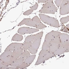 Immunohistochemical staining of human Skeletal muscle shows no positivity in myocytes as expected.