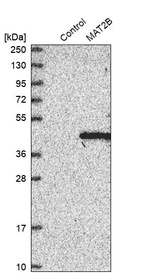 Western blot analysis in control (vector only transfected HEK293T lysate) and MAT2B over-expression lysate (Co-expressed with a C-terminal myc-DDK tag (~3.1 kDa) in mammalian HEK293T cells, LY402239).