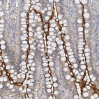 Immunohistochemical staining of human duodenum shows moderate positivity in luminal membrane in glandular cells.